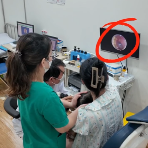 Nội soi Tai Mũi Họng Trẻ Em