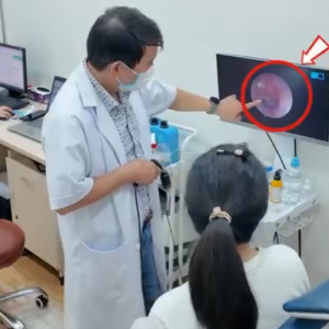 Nội soi Tai Mũi Họng người lớn