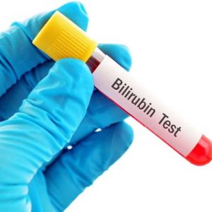 Bilirubin Gián tiếp - Đánh giá chức năng túi mật