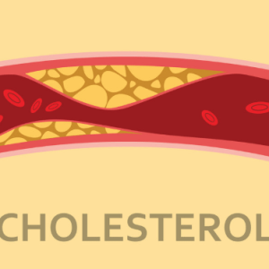 Cholesterol - Đánh giá bệnh lý về mỡ máu