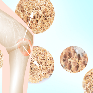 Canxi toàn phần, Canxi ion