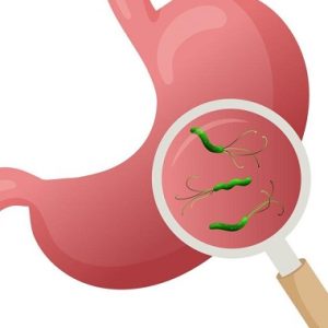 CA72-4 - Chẩn đoán sớm ung thư Dạ dày